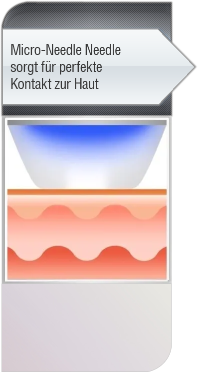 Micro-Nadel-Cartridge ist auf die Hautoberfläche gelegt